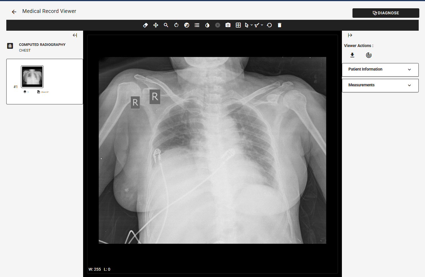 PACS Dicom Viewer screenshot 3